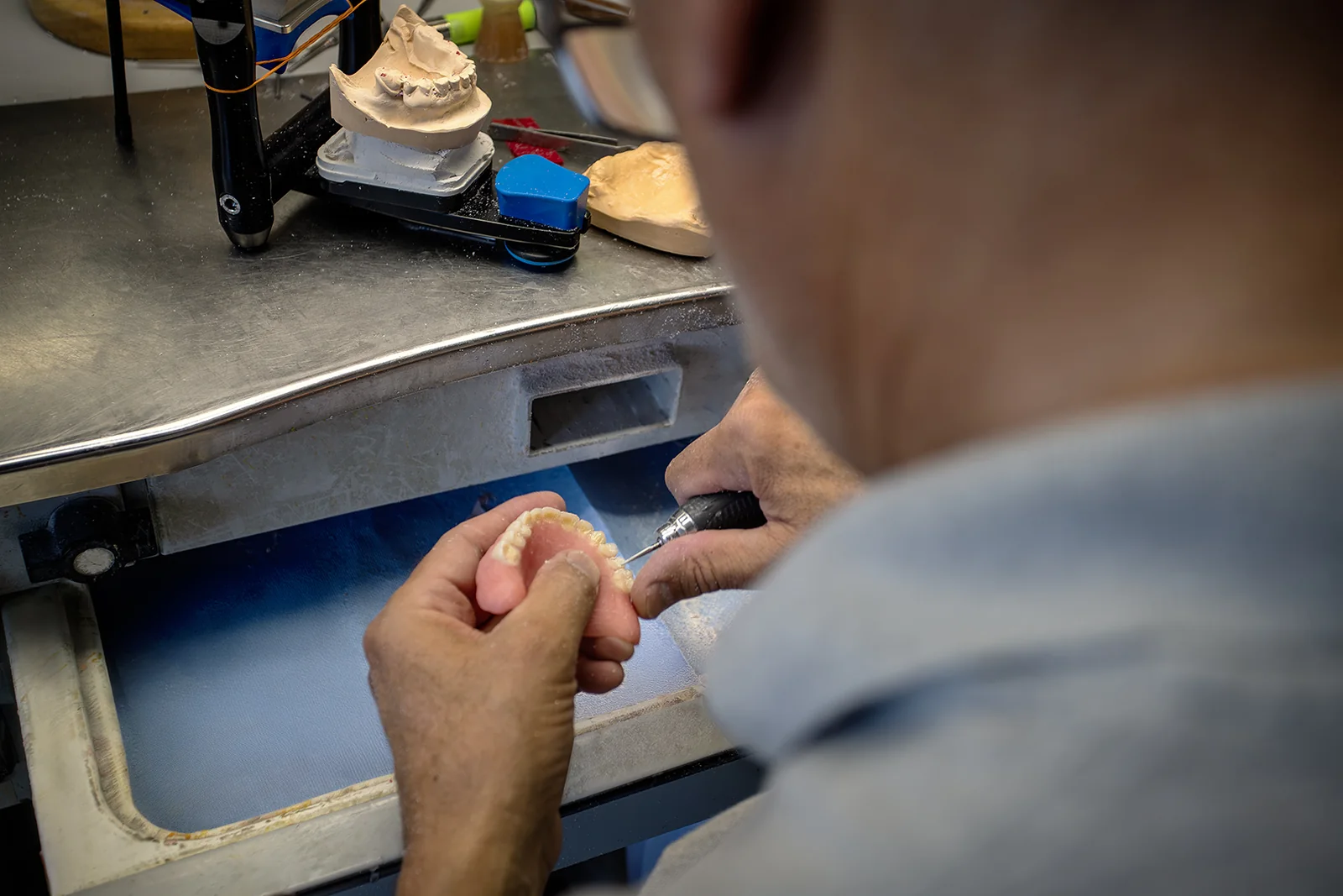 Sorgfältige Feinausarbeitung einer Zahnrestauration