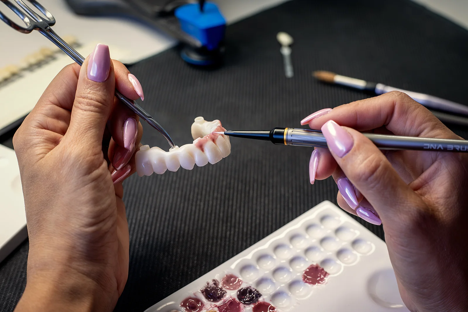 Manuelle Charakterisierung einer All-on-X-Restauration im Bridge Dental Labor