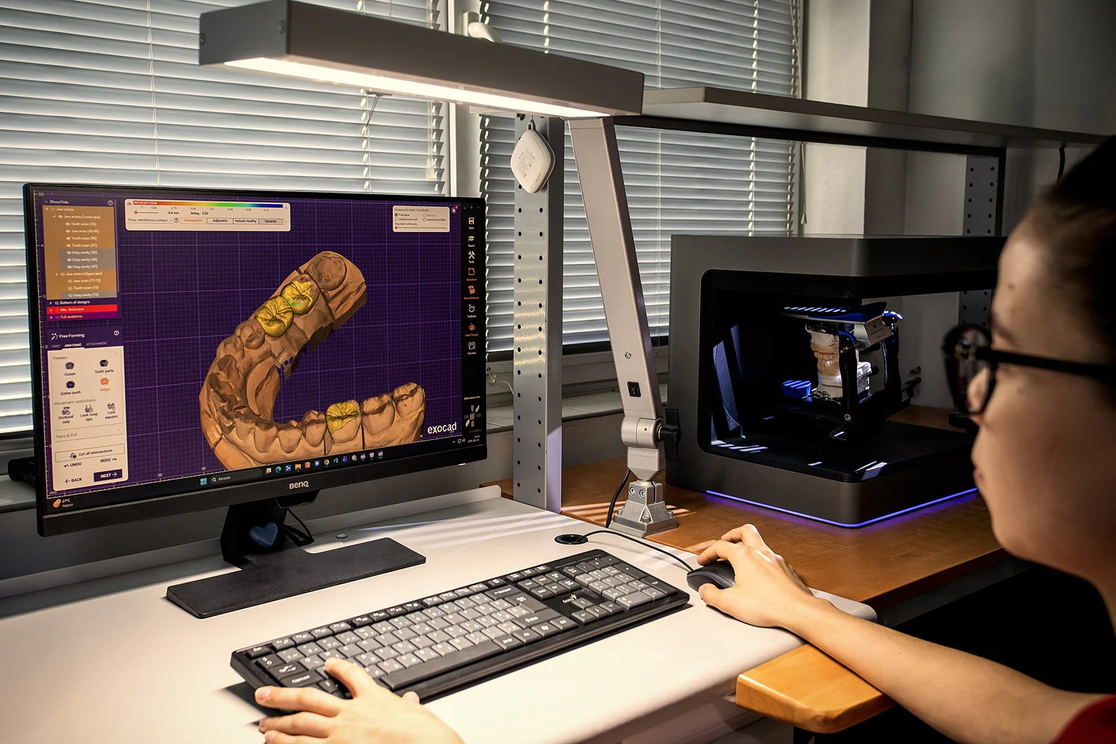 Digitale Konstruktion einer Restauration am CAD-Arbeitsplatz von Bridge Dental